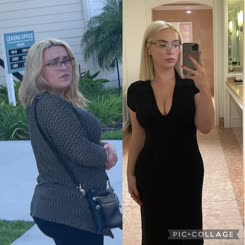 Before and after weight loss journey: How I transformed my body and life!